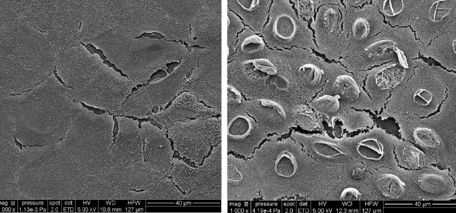 Observing water in cells can help monitor anti-cancer therapies that use light