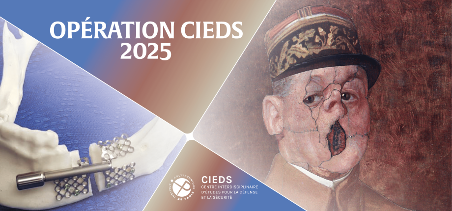 Opération CIEDS 2025 : une technologie révolutionnaire pour la reconstruction de la mâchoire des blessés de guerre