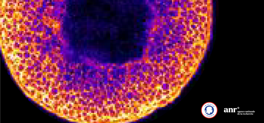 Morphoscope - Microscopie photonique 