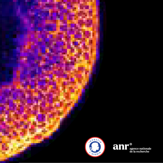 Morphoscope - Microscopie photonique